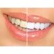 Kit de blanchiment dentaire white light pour des dents blanches