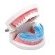 Gouttière Dentaire en Silicone - Appareil de contention orthodontique 