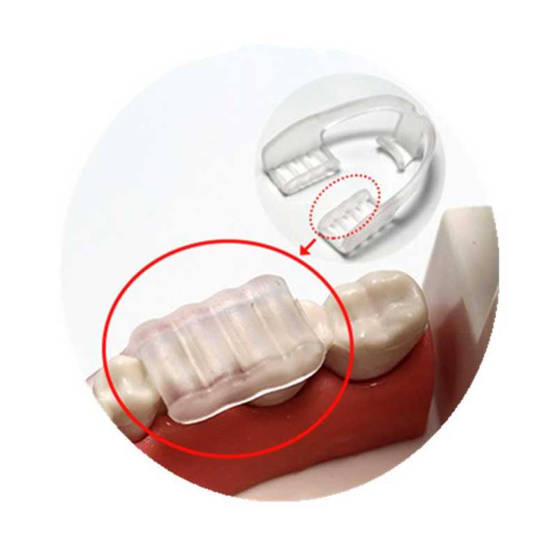Vente gouttière dentaire anti bruxisme qui supprime le grincement des dents  et les douleurs à la mâchoire - Vente en ligne de solution pour le  traitement du bruxisme - Solubrux